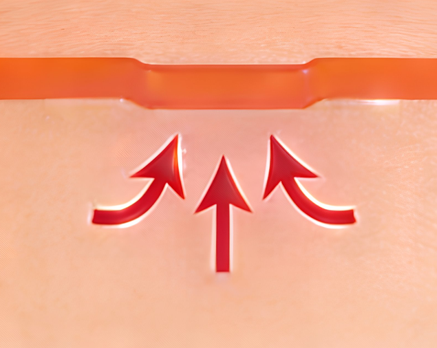 皮膚再生による陥没部位の改善