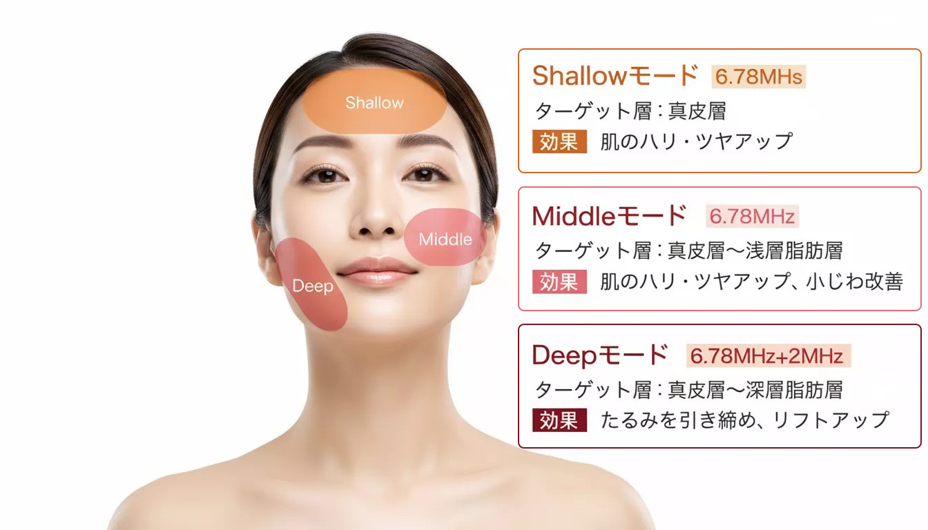 XERF（ザーフ） モード図解